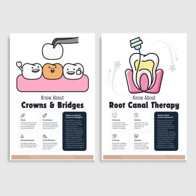 Root Canal, Crown Bridge posters | Set of 2 Unframed